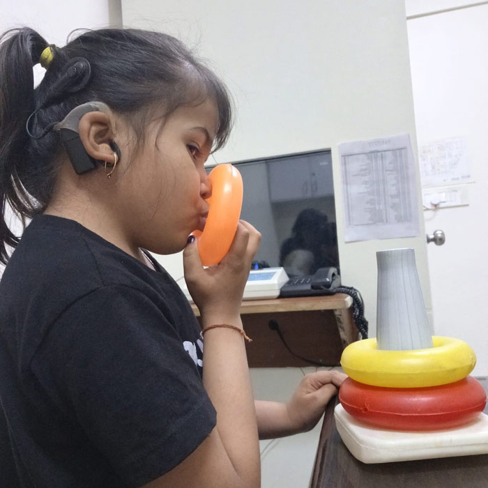 Cochlear implant,doing Auditory verbal Therapy AVT